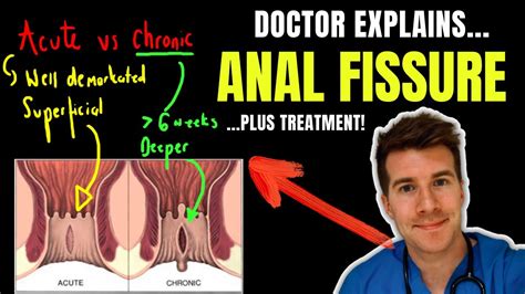 skinny teenager anal|Anal Fissure in Teens: Care Instructions .